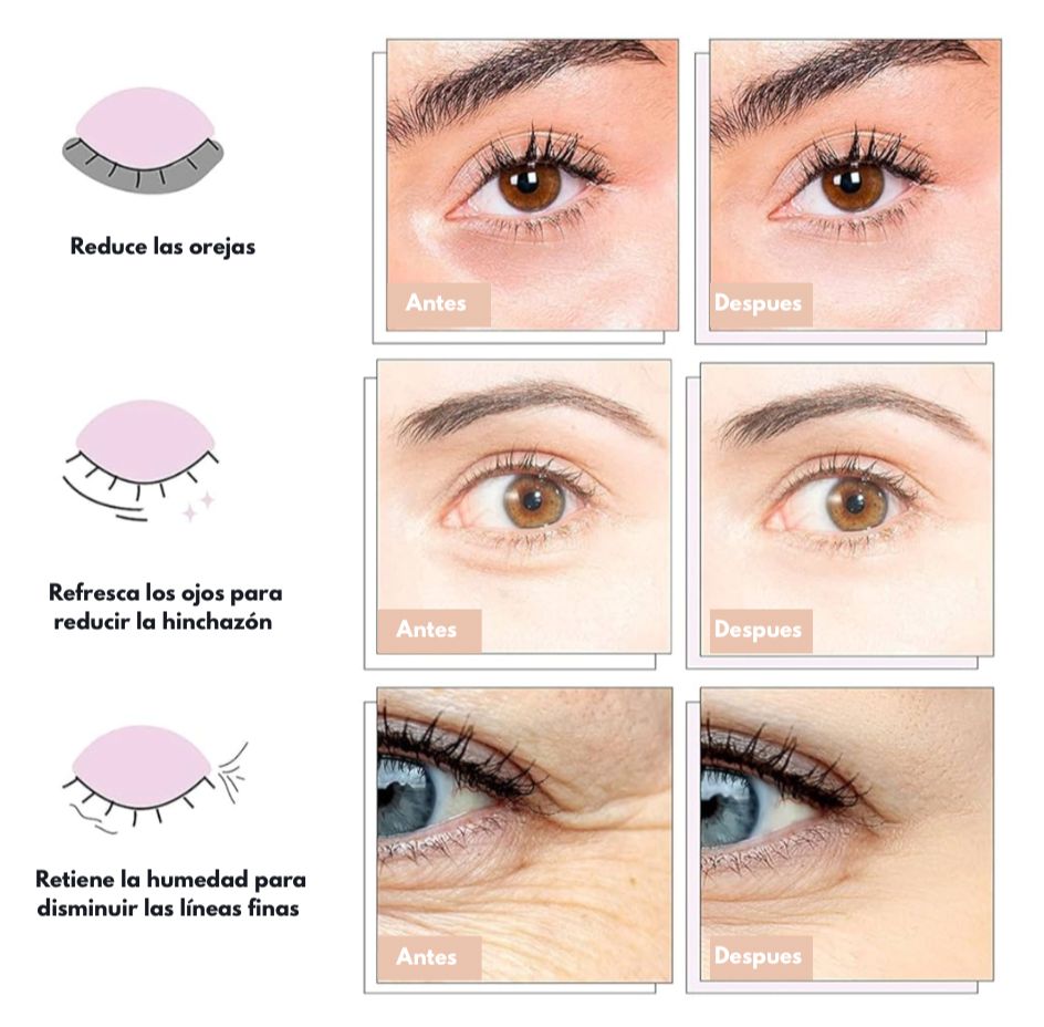 Ojeras Gold™ - Parches para ojeras de acido hialuronico X10 PARES