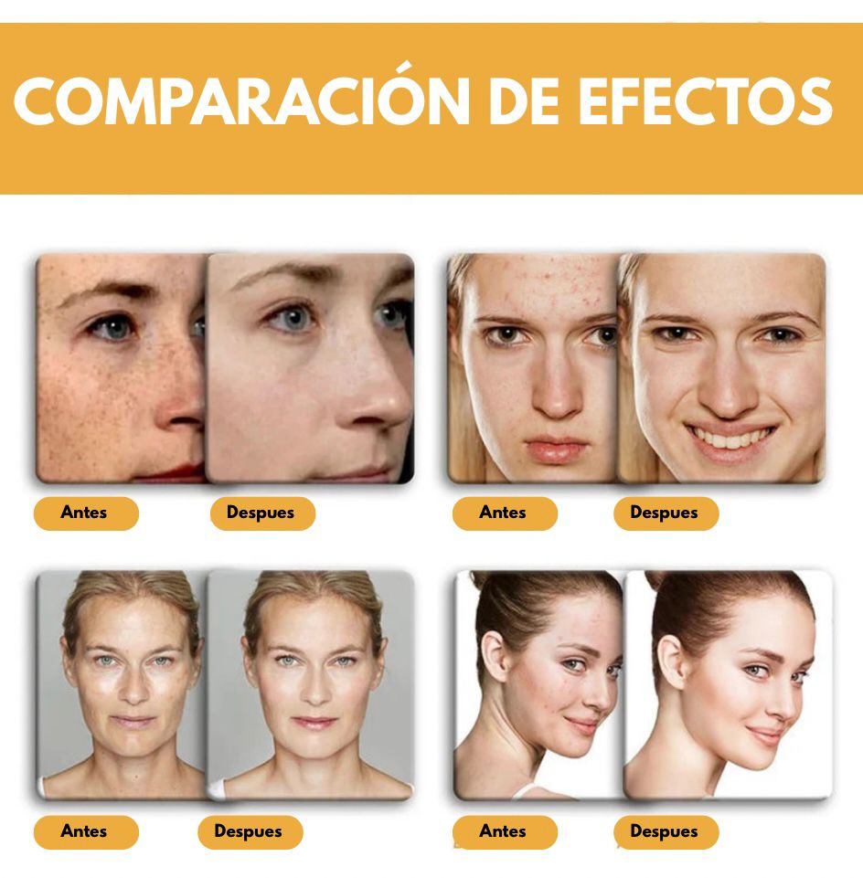 GoldenCleanse™ - Jabón de cúrcuma 🧼
