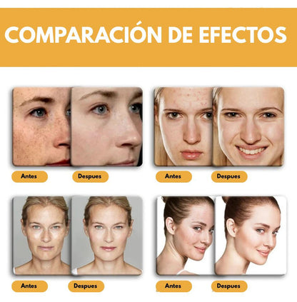 GoldenCleanse™ - Jabón de cúrcuma 🧼