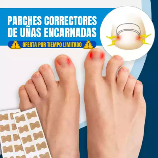 CuraNail™ - PARCHES UÑAS ENCARNADAS ANTIHONGOS