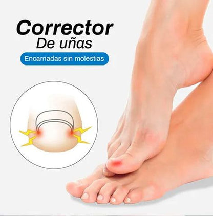 CuraNail™ - PARCHES UÑAS ENCARNADAS ANTIHONGOS