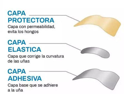 CuraNail™ - PARCHES UÑAS ENCARNADAS ANTIHONGOS